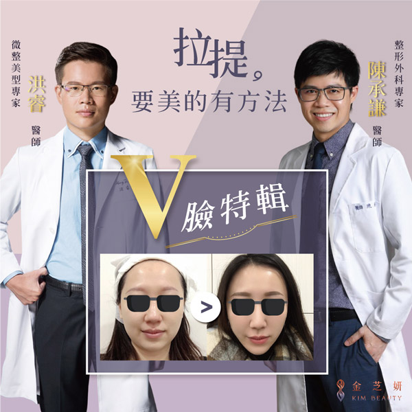 金芝妍王牌組合–V臉特輯