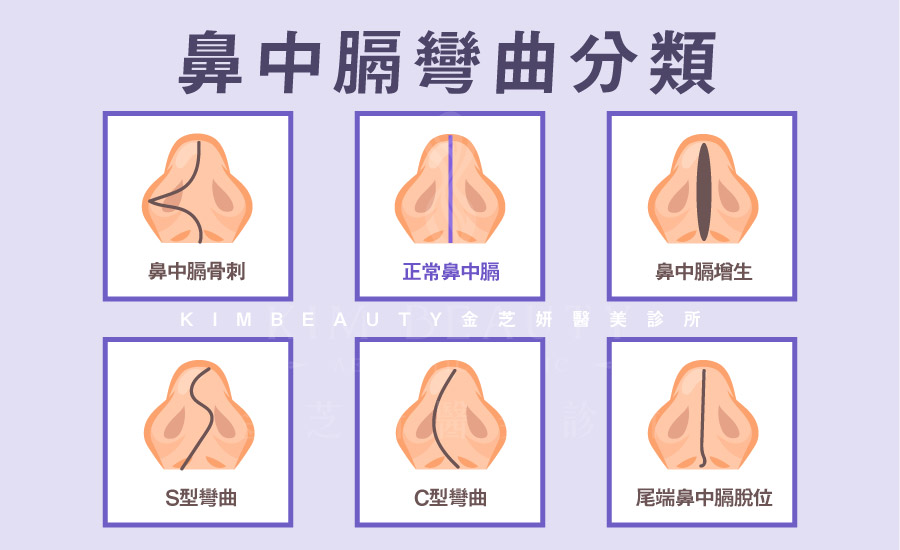 金芝妍醫美診所 鼻中膈彎曲分類圖