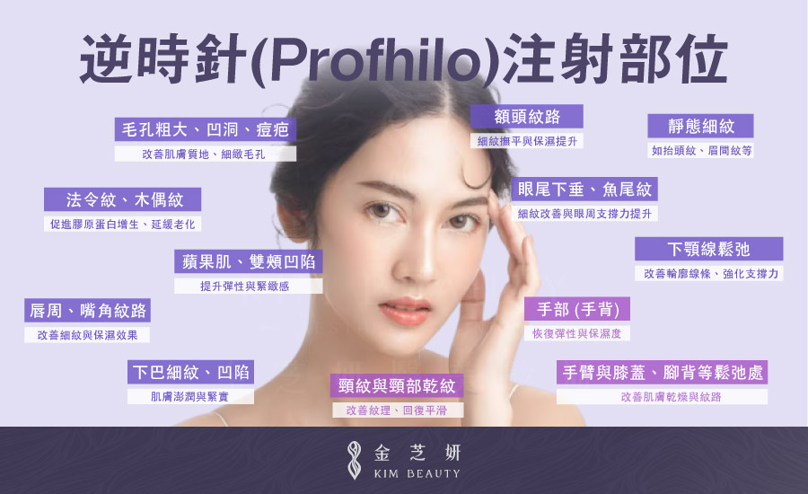 逆時針（Profhilo®）注射部位｜總整理：臉部（細紋、蘋果肌、魚尾紋、下顎線...）、頸部、其他區域（手、手背、手臂、膝蓋、腳背...）