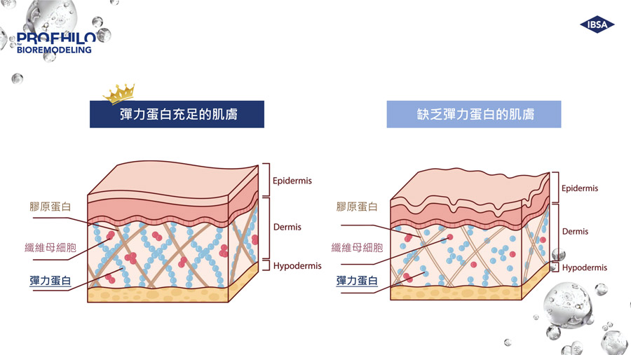 逆時針（PROFHILO® 璞菲洛）能啟動彈力蛋白增生及彈力蛋白於肌膚的重要性