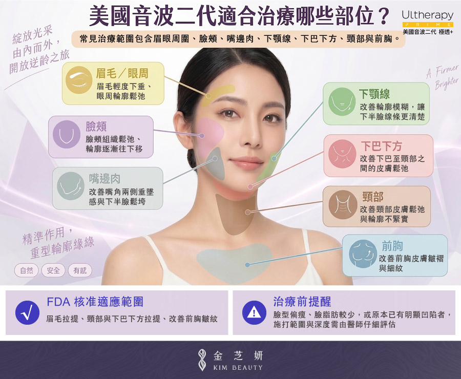 美國音波二代 Ultherapy PRIME 適合治療眉毛眼周、臉頰、嘴邊肉、下顎線、下巴下方、頸部與前胸等部位示意圖